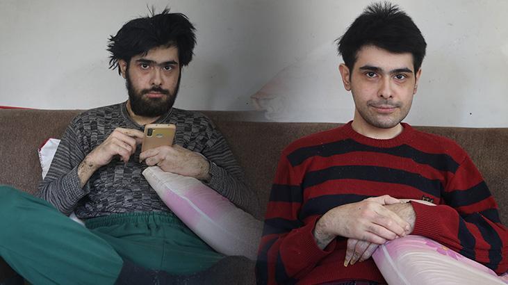 Ne duş alıyor ne tırnaklarını kesiyordu! 3 yıl sonra evden çıkan Barış’a teşhis kondu
