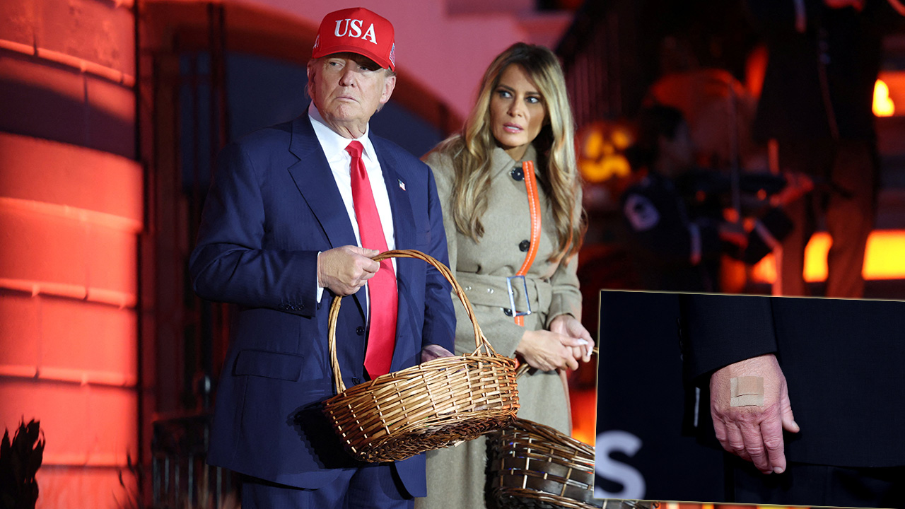 Elindeki morlukların nedenini açıkladı